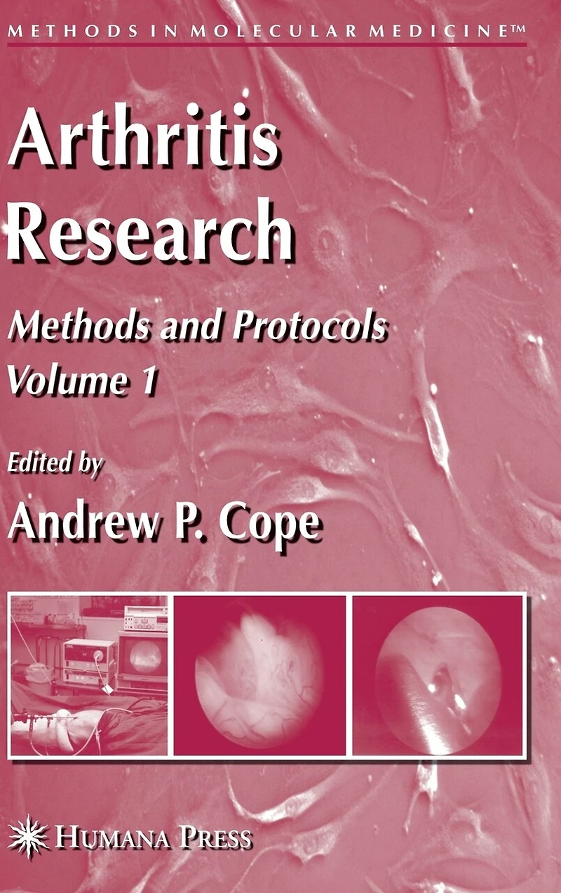 Arthritis Research: Volume 1: Methods and Protocols