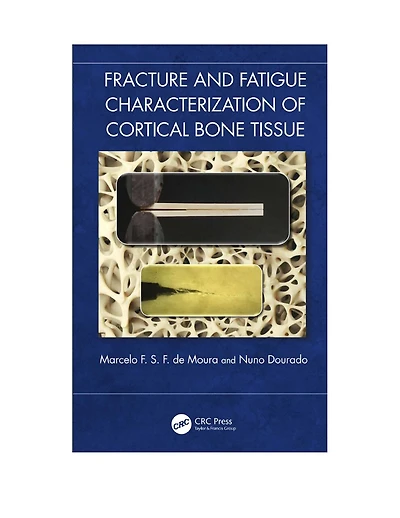Fracture and Fatigue Characterisation of Cortical Bone Tissue