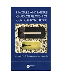 Fracture and Fatigue Characterisation of Cortical Bone Tissue