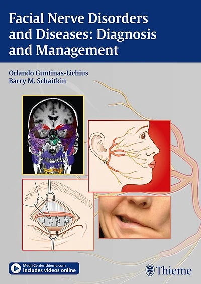 Facial Nerve Disorders And Diseases: Diagnosis Management