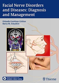 Facial Nerve Disorders And Diseases: Diagnosis Management
