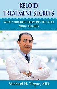 Keloid Treatment Secrets: What Your Doctor Wont Tell You.