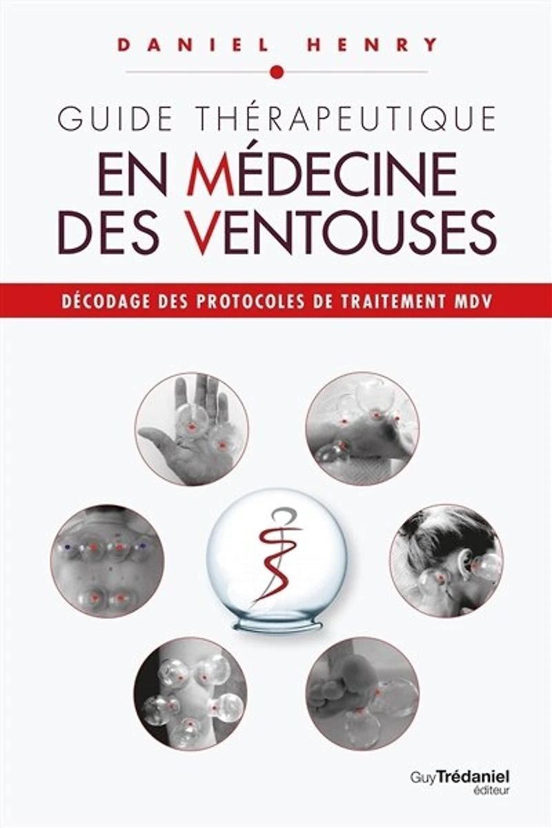 Décodage des protocoles de traitement MDV