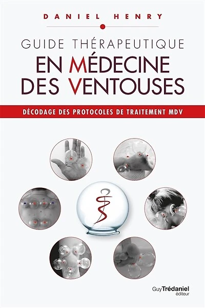 Décodage des protocoles de traitement MDV