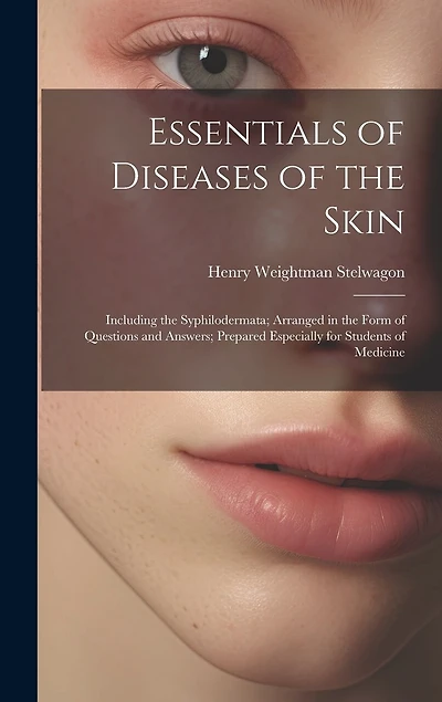 Essentials of Diseases of the Skin: Including the Syphilodermata; Arranged in the Form of Questions and Answers; Prepared Especially for Students of Medicine