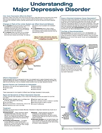 Understanding Major Depressive Disorder