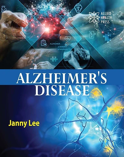 Alzheimer's disease