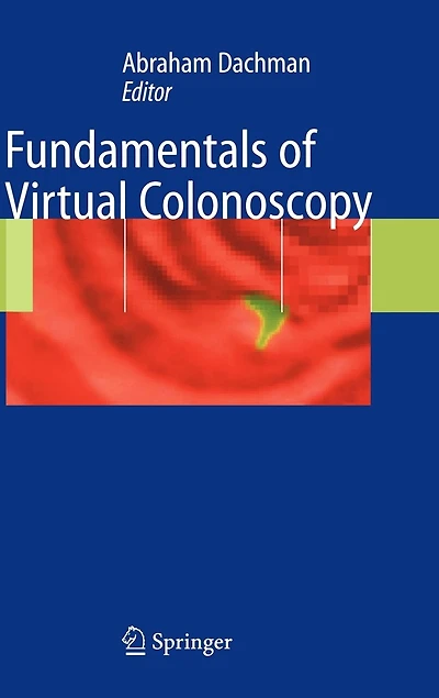 Fundamentals of Virtual Colonoscopy