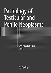 Pathology of Testicular and Penile Neoplasms