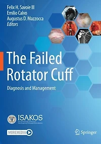 The Failed Rotator Cuff: Diagnosis and Management
