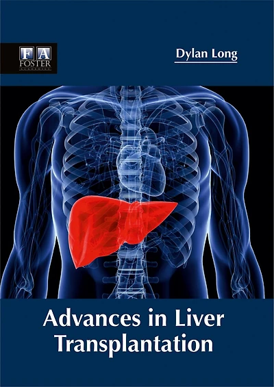Advances In Liver Transplantation
