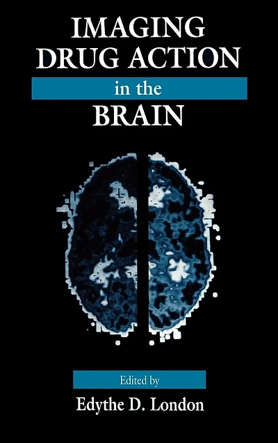 Imaging Drug Action the Brain