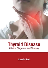 Thyroid Disease: Clinical Diagnosis And Therapy
