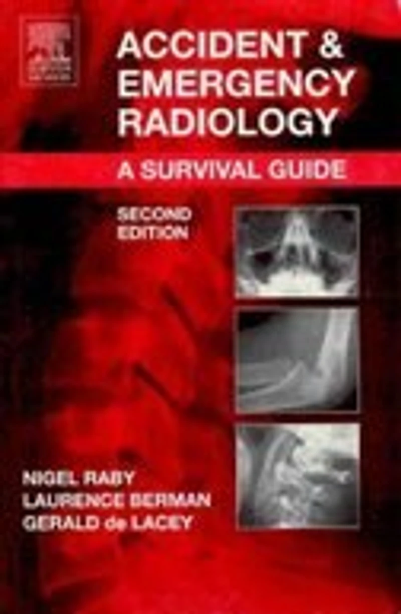 Accident and Emergency Radiology: A Survival Guide