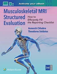 Musculoskeletal MRI Structured Evaluation: How to Efficiently Fill the Reporting Checklist