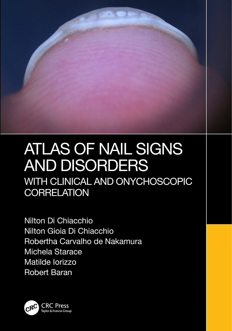 Atlas of Nail Signs and Disorders with Clinical Onychoscopic Correlation
