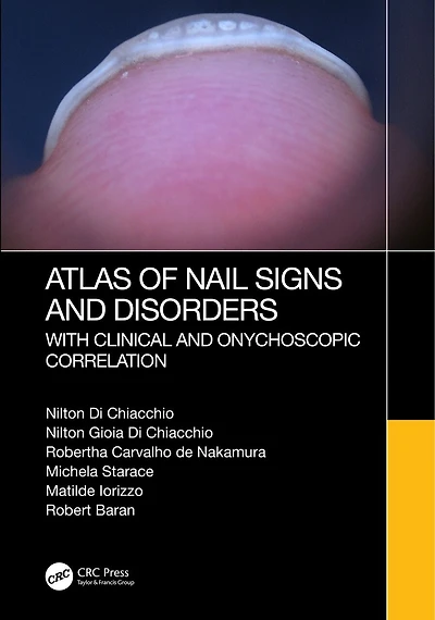 Atlas of Nail Signs and Disorders with Clinical Onychoscopic Correlation