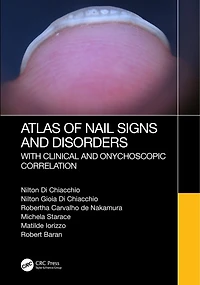Atlas of Nail Signs and Disorders with Clinical Onychoscopic Correlation