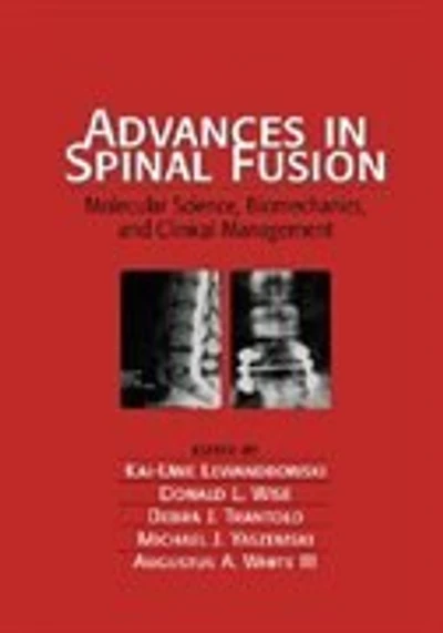 Advances Spinal Fusion: Molecular Science, BioMechanics, and Clinical Management