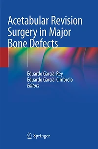 Acetabular Revision Surgery Major Bone Defects