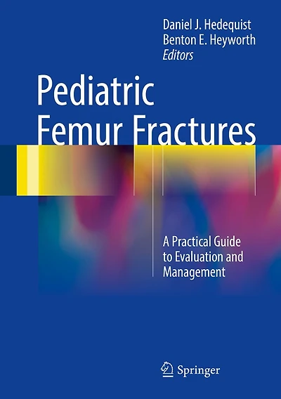 Pediatric Femur Fractures: A Practical Guide To Evaluation And Management