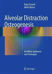 Alveolar Distraction Osteogenesis: The Archwise Appliance And Technique