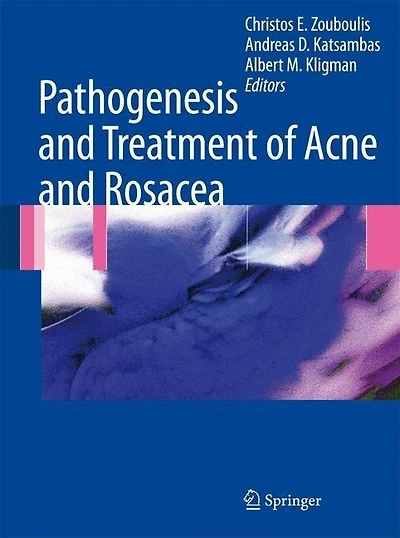 Pathogenesis and Treatment of Acne Rosacea