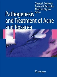 Pathogenesis and Treatment of Acne Rosacea