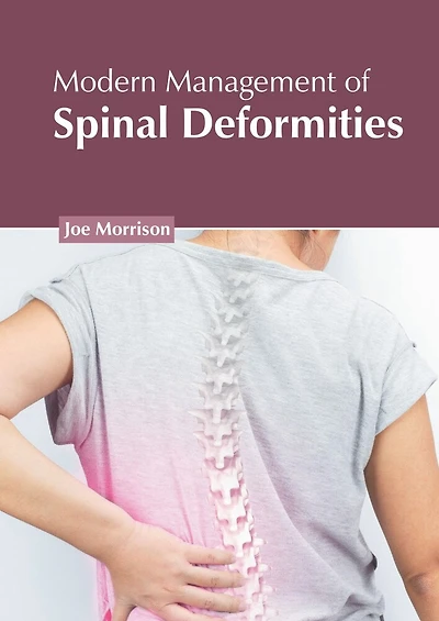 Modern Management of Spinal Deformities