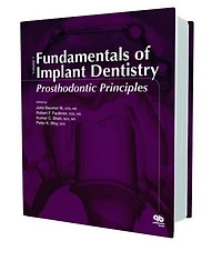 Fundamentals of Implant Dentistry: Prosthodontic Principles (Volume I)