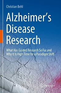 Alzheimer's Disease Research: What Has Guided Research So Far and Why It Is High Time for a Paradigm Shift