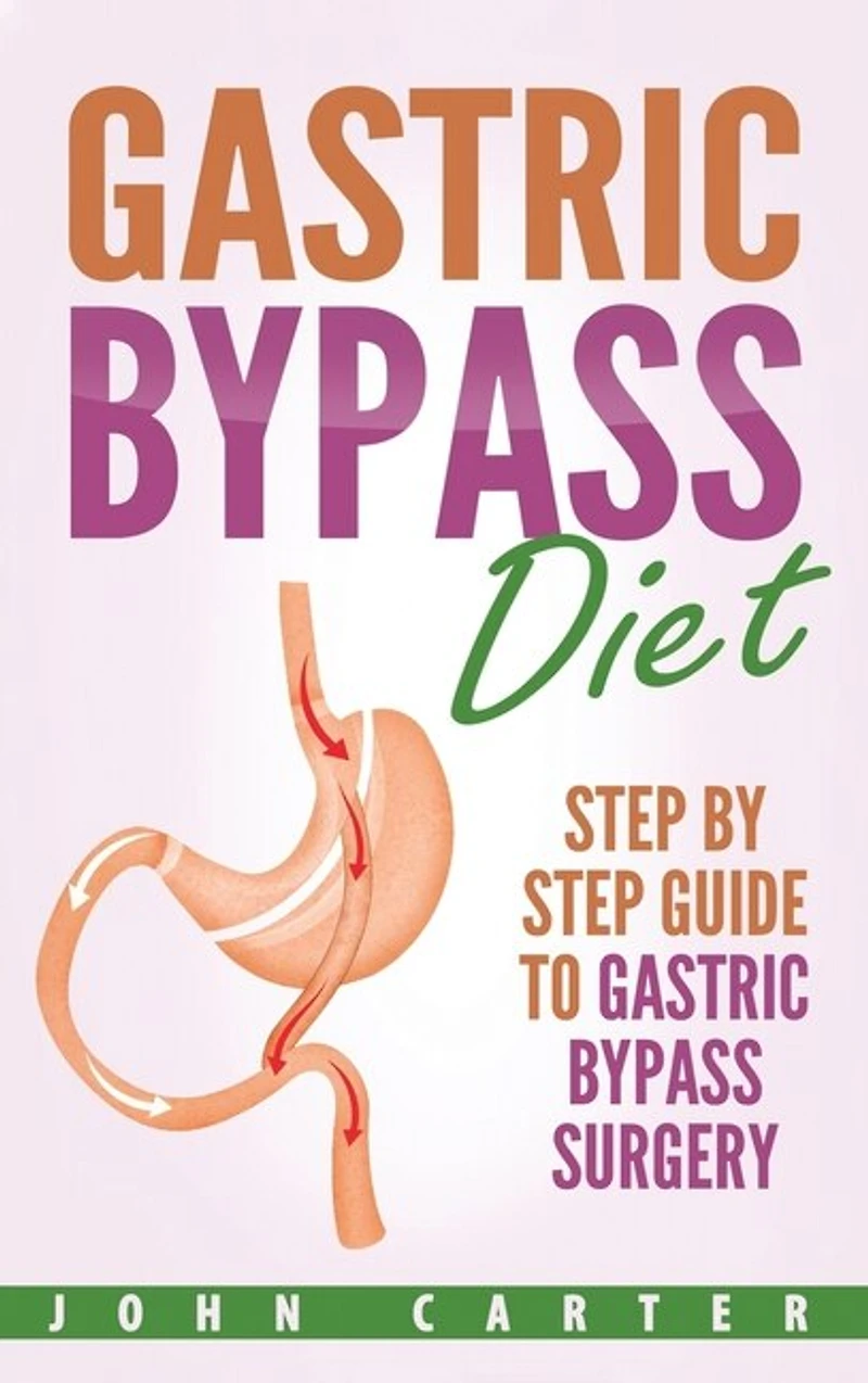 Gastric Bypass Diet: Step By Guide To Surgery