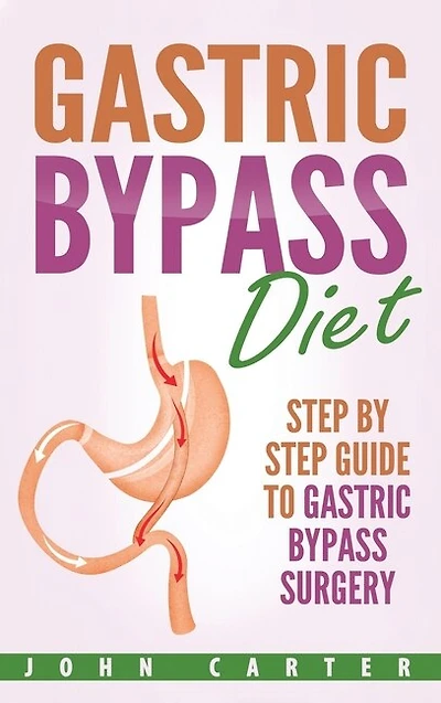 Gastric Bypass Diet: Step By Guide To Surgery