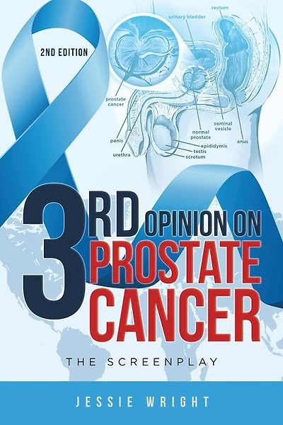 3rd Opinion On Prostate Cancer: The Screenplay