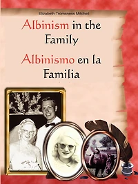 Albinism in the Family: Albinismo en la Familia