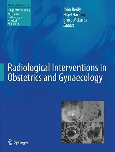 Radiological Interventions Obstetrics and Gynaecology