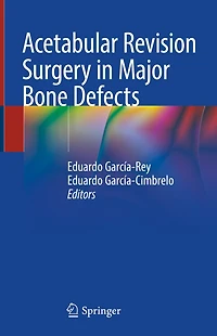 Acetabular Revision Surgery Major Bone Defects