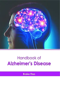 Handbook of Alzheimer's Disease