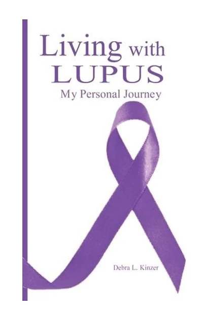Living with Lupus: : My Personal Journey