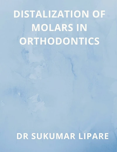Distalization of Molars in Orthodontics