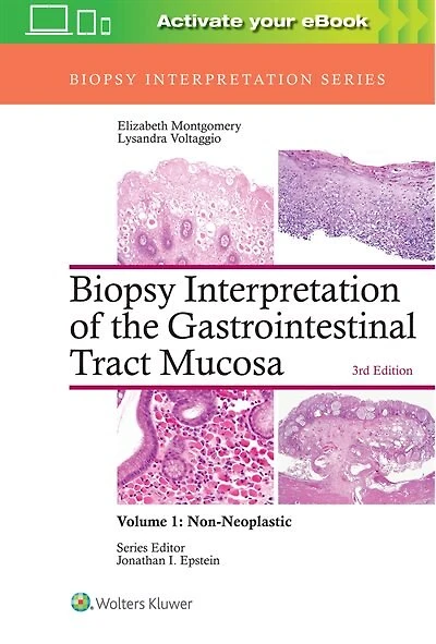 Biopsy Interpretation of the Gastrointestinal Tract Mucosa Volume 1: Non-Neoplastic: Print + eBook with Multimedia