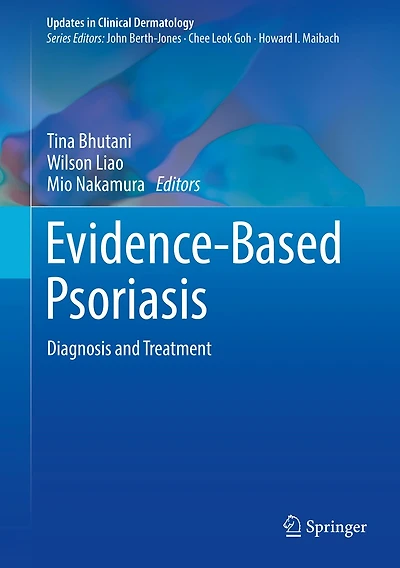 Evidence-based Psoriasis: Diagnosis And Treatment