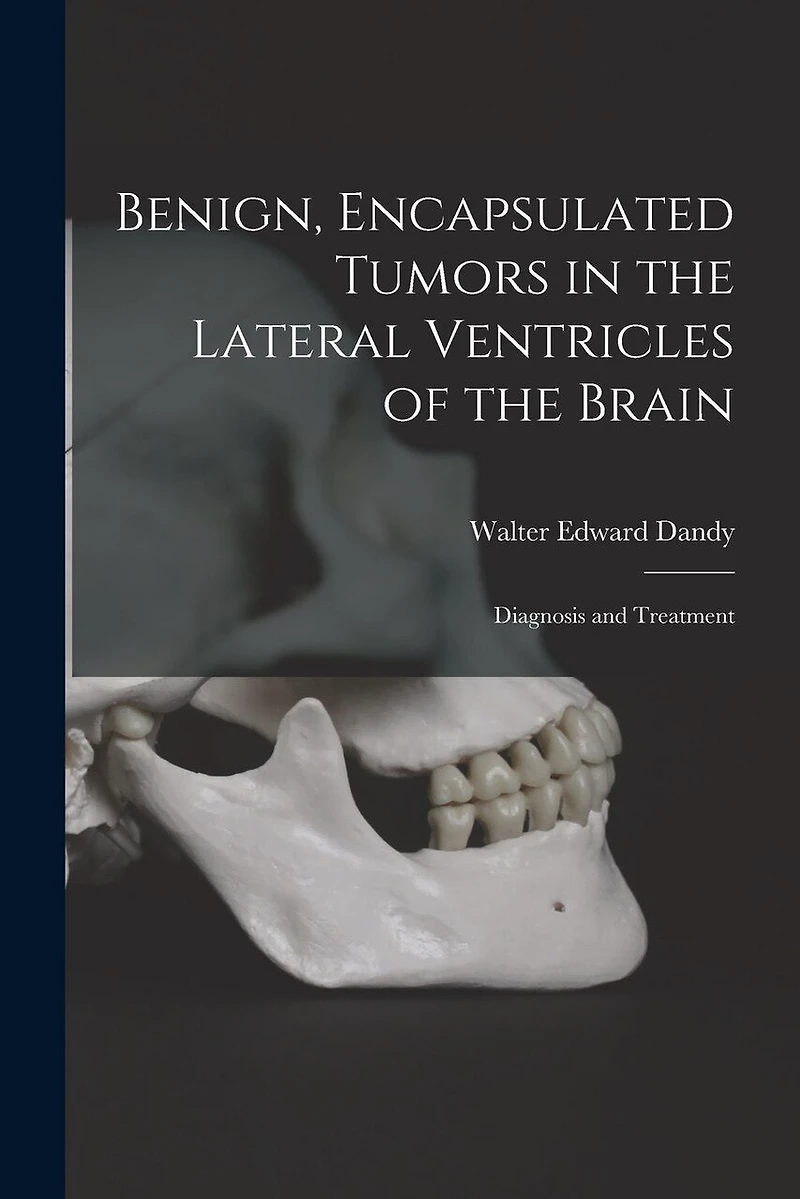 Benign, Encapsulated Tumors in the Lateral Ventricles of the Brain: Diagnosis and Treatment