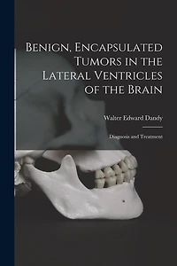 Benign, Encapsulated Tumors in the Lateral Ventricles of the Brain: Diagnosis and Treatment