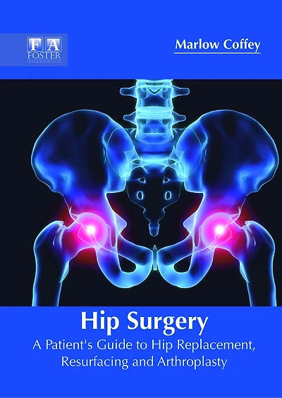Hip Surgery: A Patient's Guide To Hip Replacement, Resurfacing And Arthroplasty