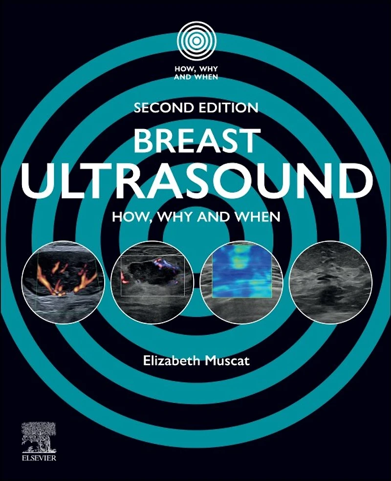 Breast Ultrasound: How, Why and When