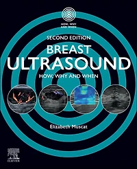 Breast Ultrasound: How, Why and When