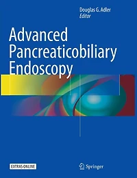 Advanced Pancreaticobiliary Endoscopy