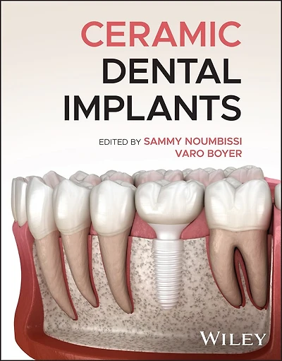Ceramic Dental Implants