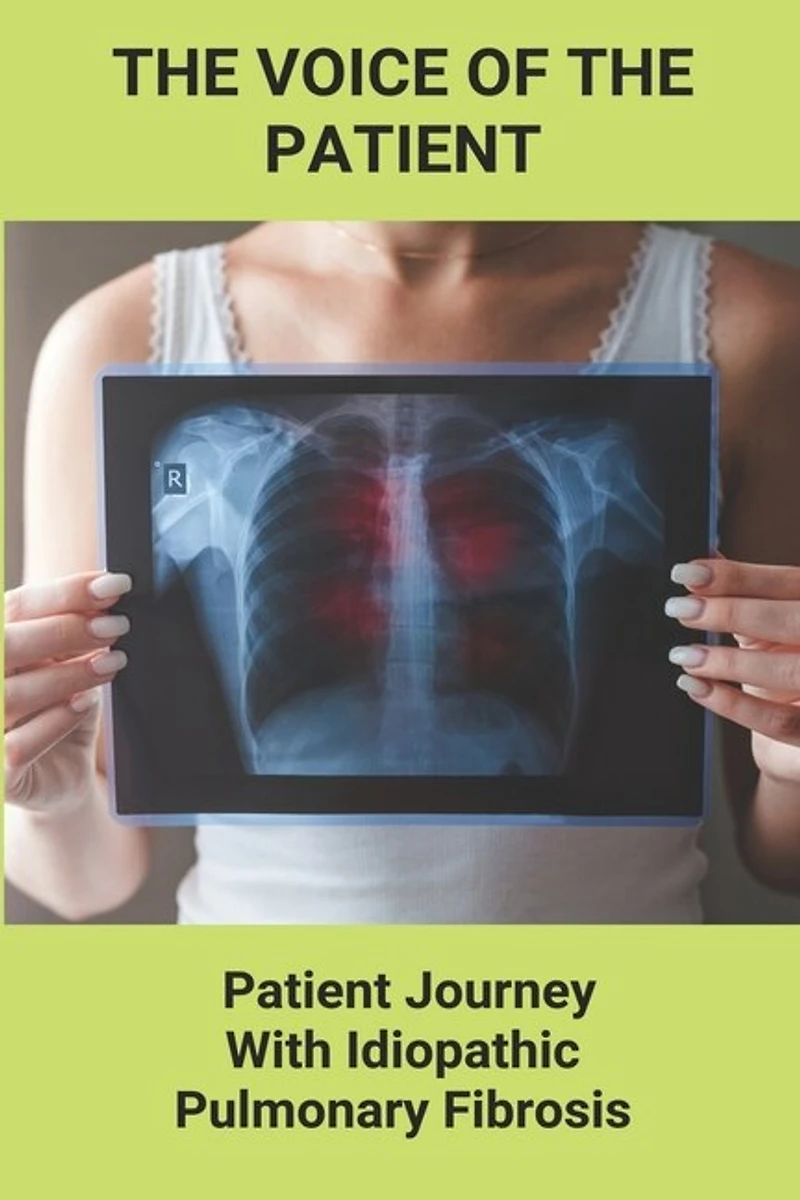 The Voice Of The Patient: Patient Journey With Idiopathic Pulmonary Fibrosis: New Mountains To Climb